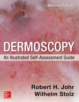 DERMOSCOPY: AN ILLUSTRATED SELF-ASSESSMENT GUIDE