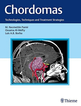 CHORDOMAS TECHNOLOGIES TECHNIQUES AND TREATMENT STRATEGIES