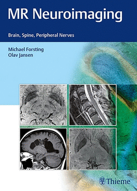 SPINE AND PERIPHERAL NERVES MR NEUROIMAGING