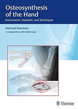 OSTEOSYNTHESIS OF THE HAND. INSTRUMENTS IMPLANTS AND TECHNI