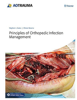 PRINCIPLES OF ORTHOPEDIC INFECTION MANAGEMENT