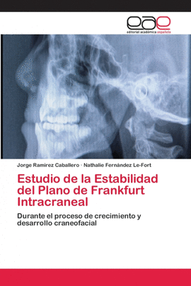 ESTUDIO DE LA ESTABILIDAD DEL PLANO DE FRANKFURT INTRACRANEAL