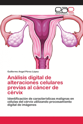 AN�LISIS DIGITAL DE ALTERACIONES CELULARES PREVIAS AL C�NCER DE C�RVIX