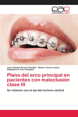 PLANO DEL ARCO PRINCIPAL EN PACIENTES CON MALOCLUSI�N CLASE III