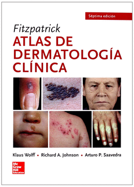 FITZPATRICK. ATLAS VISUAL DE DERMATOLOGIA
