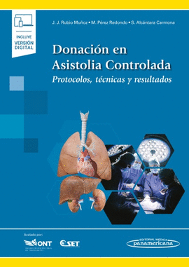 DONACI�N EN ASISTOLIA CONTROLADA (VERSI�N D�O)