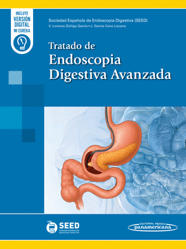 TRATADO DE ENDOSCOPIA DIGESTIVA AVANZADA