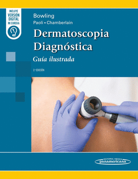DERMATOSCOPIA DIAGNSTICA