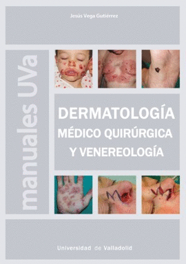 DERMATOLOGIA MEDICO QUIRURGICA Y VENEREOLOGIA