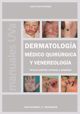 DERMATOLOG�A M�DICO QUIR�RGICA Y VENEREOLOG�A. TERCERA EDICI�N REVISADA Y AMPLIA