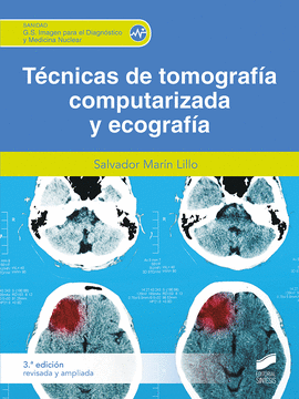TECNICAS DE TOMOGRAFIA COMPUTERIZADA Y ECOGRAFIA 2� ED