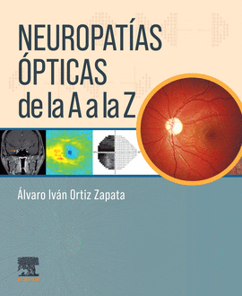 NEUROPAT�AS �PTICAS DE LA A A LA Z