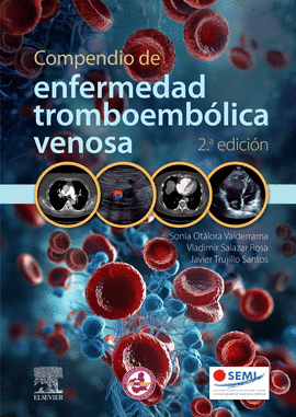 COMPENDIO DE ENFERMEDAD TROMBOEMBOLICA VENOSA 2 ED