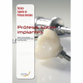 PR�TESIS SOBRE IMPLANTES