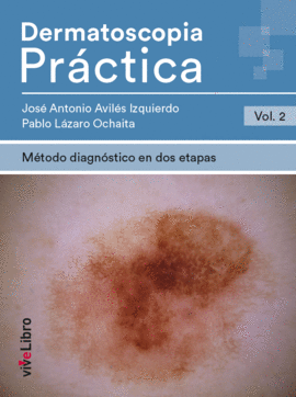 DERMATOSCOPIA PR�CTICA. VOL. 2: M�TODO DIAGN�STICO EN DOS ETAPAS