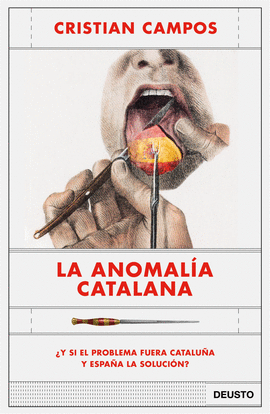 LA ANOMALA CATALANA