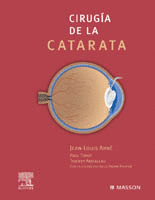 CIRUG�A DE LA CATARATA