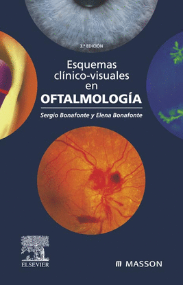ESQUEMAS CL�NICO-VISUALES EN OFTALMOLOG�A