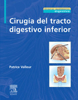 CIRUG�A DEL TRACTO DIGESTIVO INFERIOR