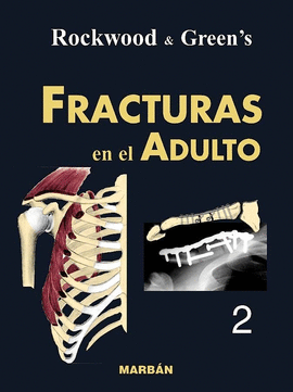 FRACTURAS EN EL ADULTO VOL 2