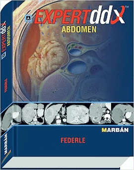 EXPERT DDX ABDOMEN
