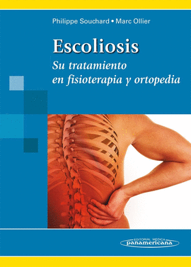 SOUCHARD:ESCOLIOSIS