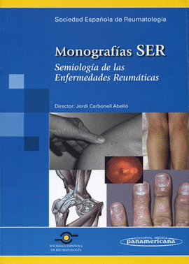 SER.SEMIOLOG?A ENFERMED. REUM?TICAS