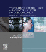 TRATAMIENTO ORTOD�NCICO PACIENTES CLASE 2 NO COLABORADORES