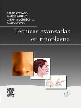 T�CNICAS AVANZADAS EN RINOPLASTIA + STUDENTCONSULT EN ESPA�OL