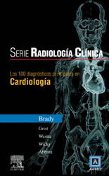 LOS 100 DIAGN�STICOS PRINCIPALES EN CARDIOLOG�A