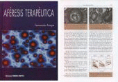 AF�RESIS TERAPEUTICA
