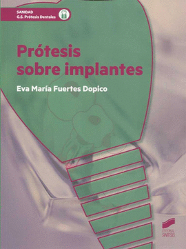 PROTESIS SOBRE IMPLANTES