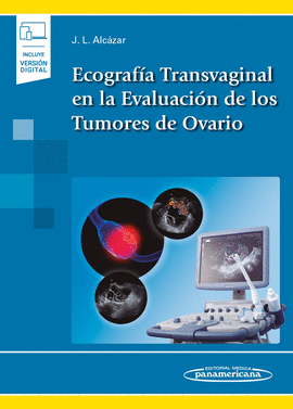 ECOGRAFA TRANSVAGINAL EN LA EVALUACIN DE LOS TUMORES DE OVARIO (INCLUYE VERSI