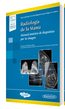 TRATADO DE RADIOLOGIA DE LA MAMA