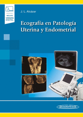 ECOGRAFA EN PATOLOGA UTERINA Y ENDOMETRIAL (INCLUYE VERSIN DIGITAL)