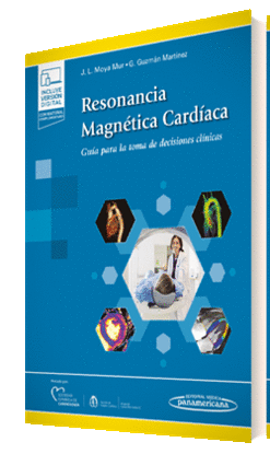 RESONANCIA MAGNETICA CARDIACA
