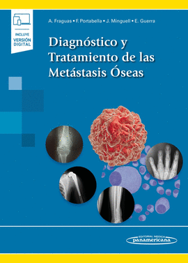 DIAGN�STICO Y TRATAMIENTO DE LAS MET�STASIS �SEAS (INCLUYE VERSI�N DIGITAL)