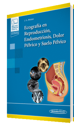 ECOGRAFA EN REPRODUCCIN, ENDOMETRIOSIS, DOLOR PLVICO Y SUELO PLVICO (+E-BOOK