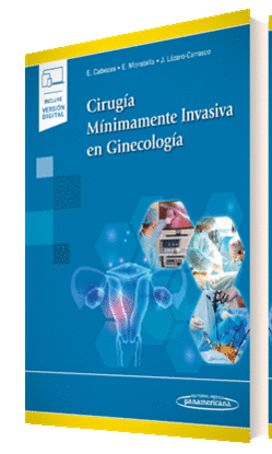 CIRUGA MNIMAMENTE INVASIVA EN GINECOLOGA