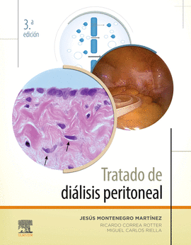 TRATADO DE DILISIS PERITONEAL (3 ED.)