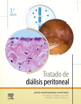 TRATADO DE DI�LISIS PERITONEAL (3� ED.)