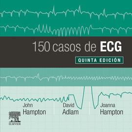 150 CASOS DE ECG (5 ED.)