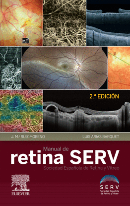 MANUAL DE RETINA SERV (2� ED.)