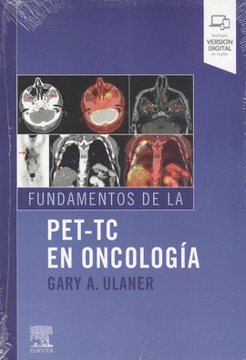 FUNDAMENTOS DE LA PET-TC EN ONCOLOGIA