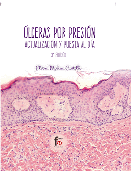 ULCERAS POR PRESION.-3 EDICION