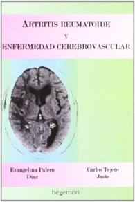 ARTRITIS REUMATOIDE Y ENFERMEDAD CEREBROVASCULAR