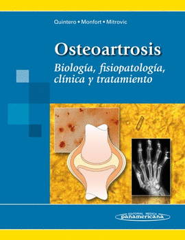 OSTEOARTROSIS
