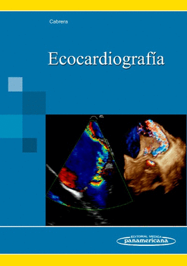 ECOCARDIOGRAF�A