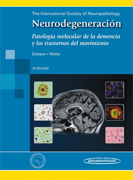 NEURODEGENERACIN.