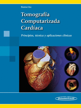 TOMOGRAF�A COMPUTARIZADA CARD�ACA